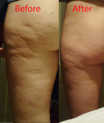 beforeandafter